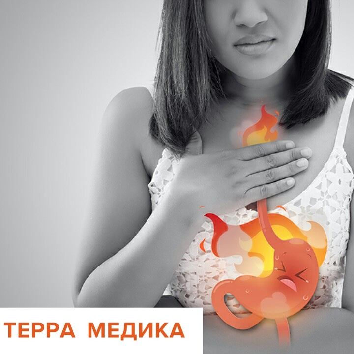 Изжога.