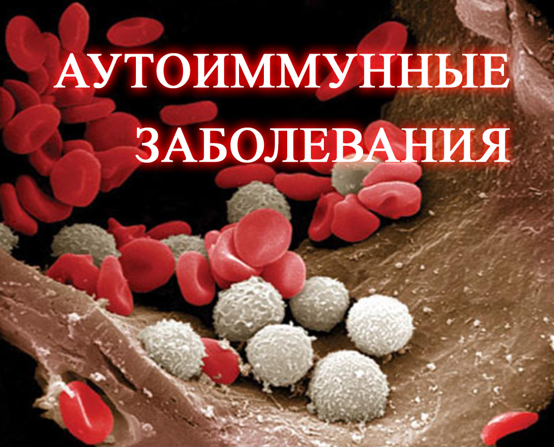 Аутоиммунные заболевания.