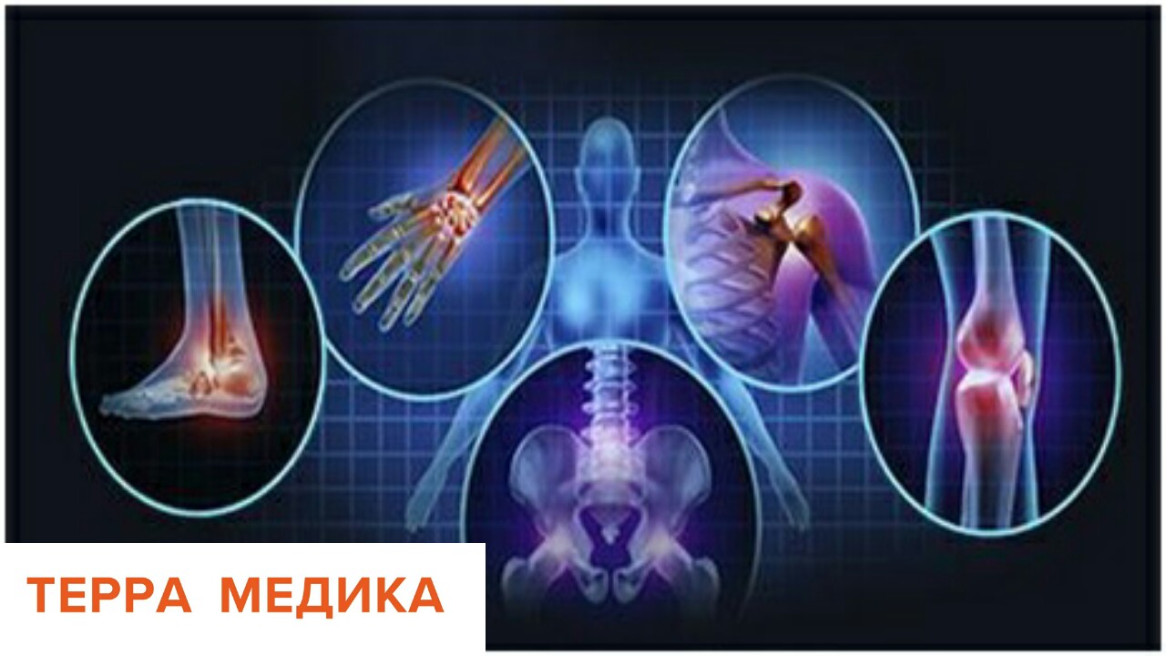 Ревматология