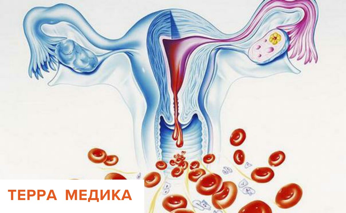 Гипоменорея