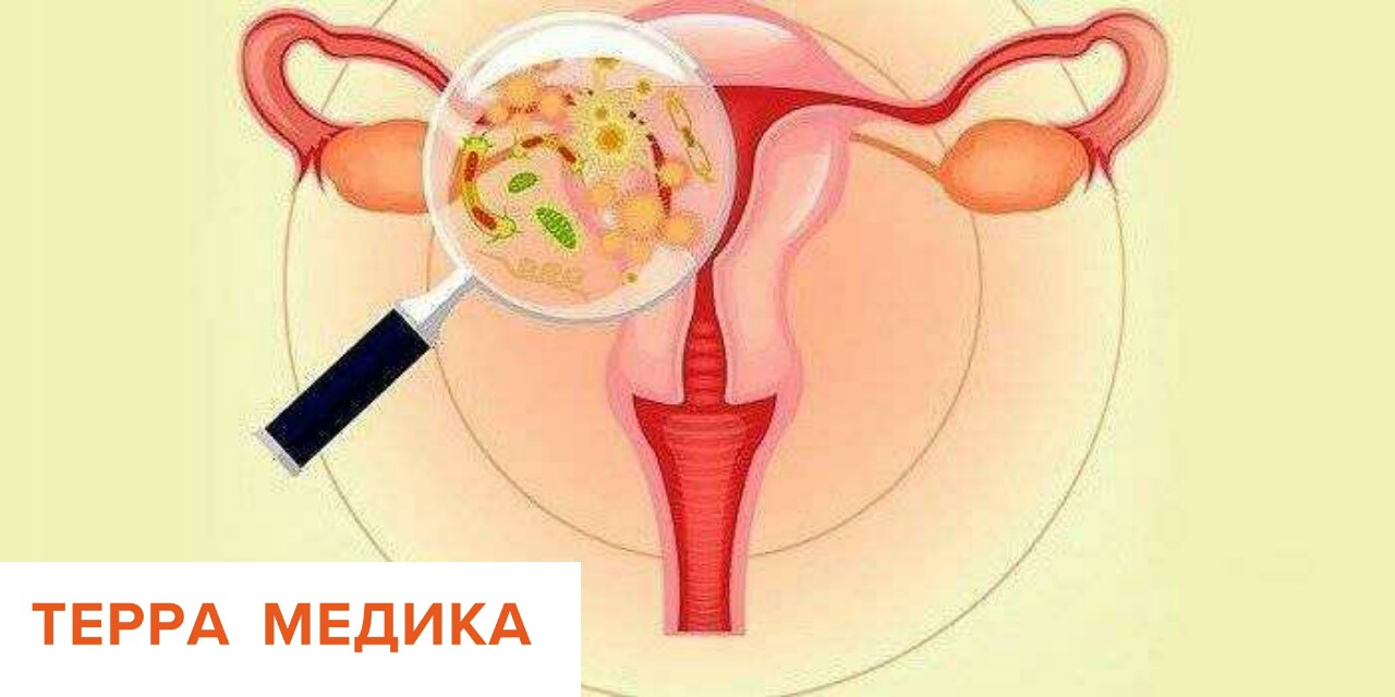 Вагинит (кольпит)