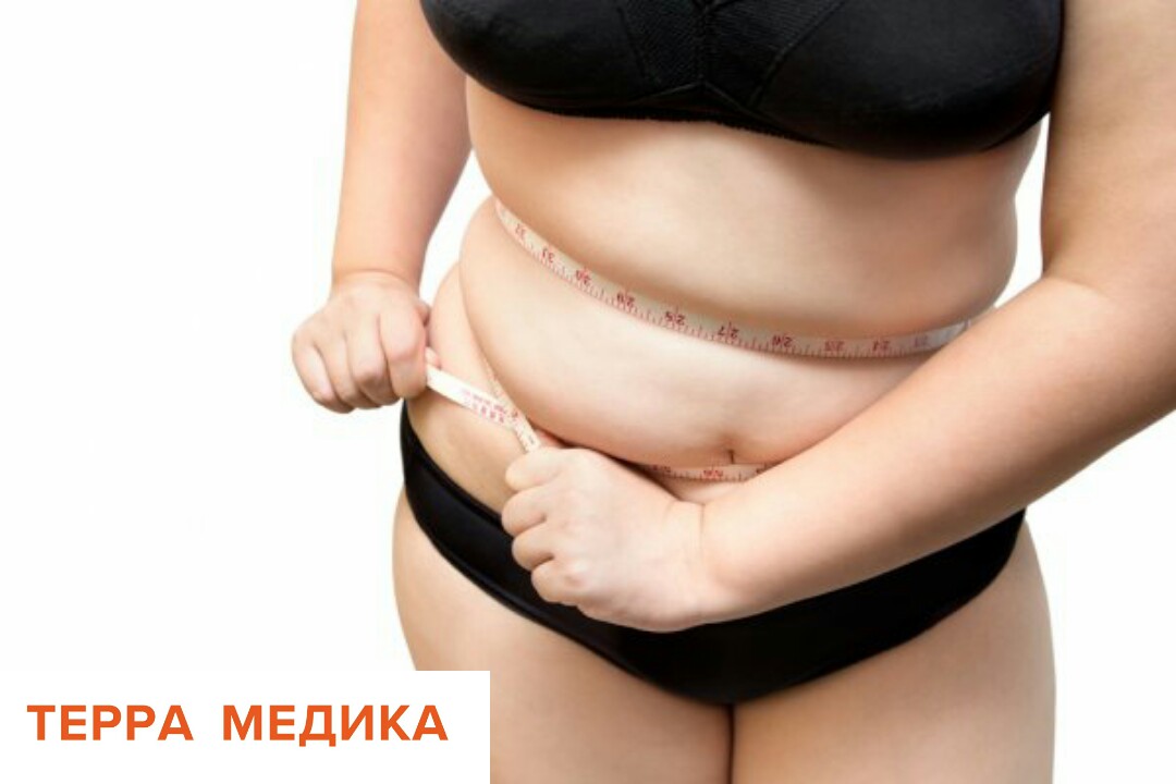 Метаболический синдром