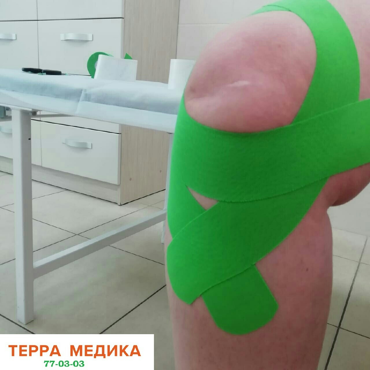 Пациентка с остеоартрозом коленного сустава