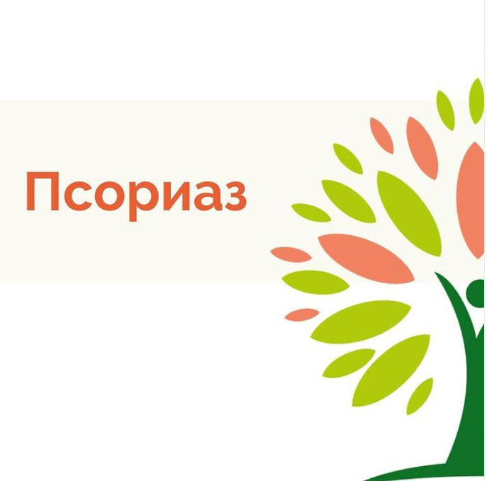 Псориаз