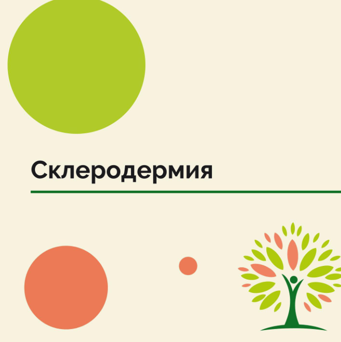 Склеродермия