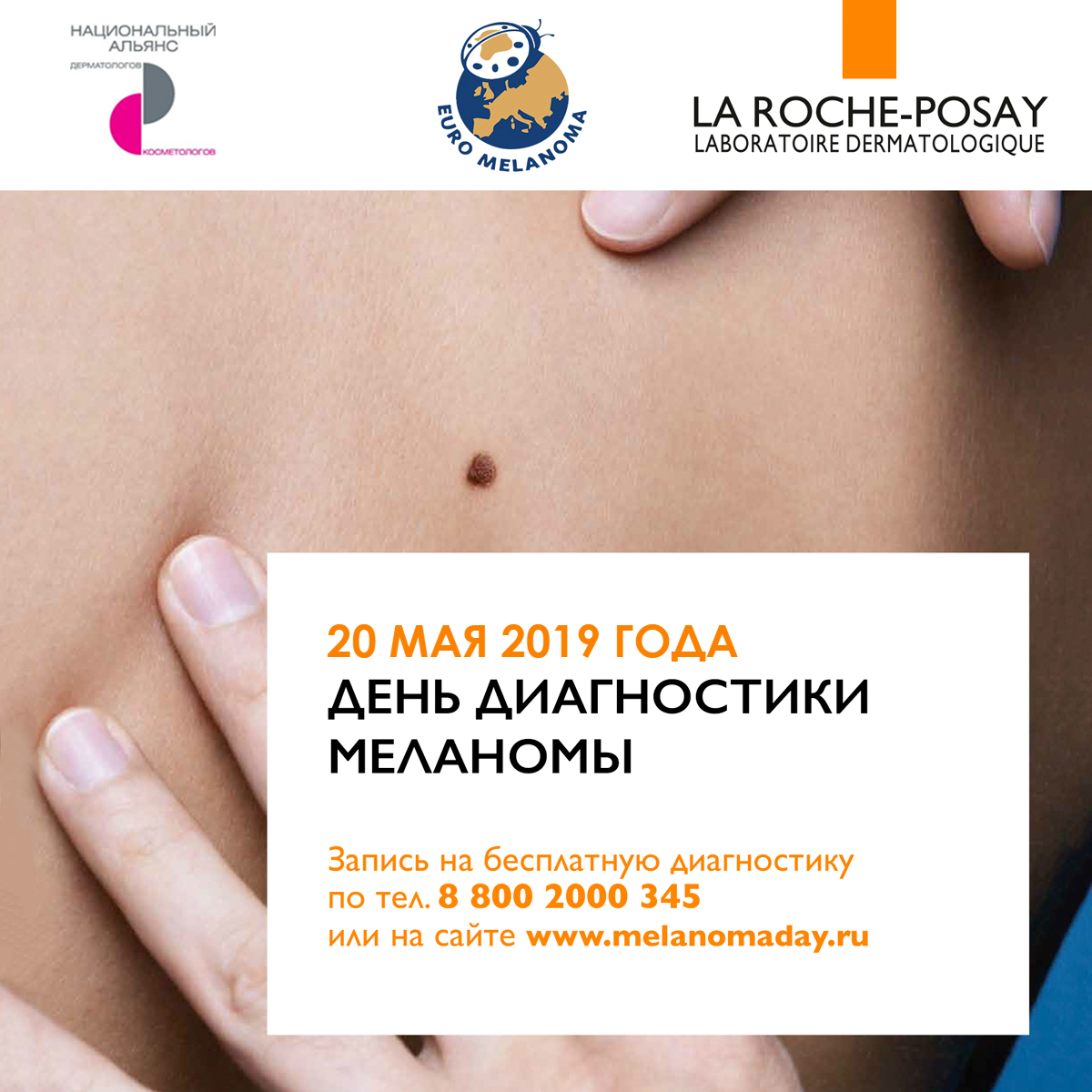 День бесплатной диагностики меланомы!